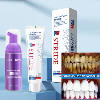 Препарат за отстраняване на зъбен камък Избелване на зъби Мус Паста за зъби Отстраняване на миризма в устата Лош дъх Предотвратяване на пародонтит Орални продукти