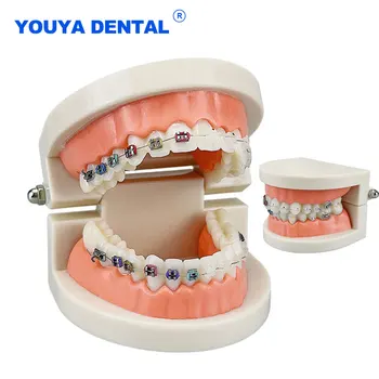 Стандартен модел на зъбите Модел на дентално ортодонтско лечение Половин керамична скоба Половин метална скоба Студент по зъболекар Преподаване Демо