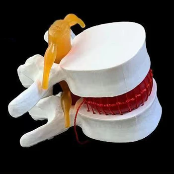 2Видове медицински подпори Модел Анатомичен гръбначен стълб Лумбална дискова херния Анатомия Комплект инструменти за медицинско обучение Консумативи за училищна употреба